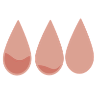 Es gibt leichte Einschränkungen im Alltag